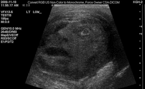 Rostro_testiculos Rostro_testiculos